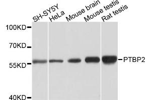 Western blot analysis of extracts of various cell lines, using PTBP2 antibody (ABIN5973595) at 1/1000 dilution. (PTBP2 Antikörper)