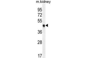 Western Blotting (WB) image for anti-Cyclin-Dependent Kinase Inhibitor 1C (p57, Kip2) (CDKN1C) antibody (ABIN2995933) (CDKN1C Antikörper)