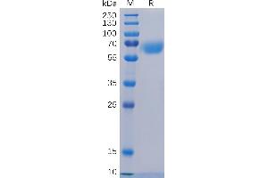 Human CD48 Protein, hFc Tag on SDS-PAGE under reducing condition. (CD48 Protein (CD48) (AA 27-220) (Fc Tag))