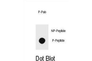 Dot blot analysis of Phospho-PTEN- Antibody Phospho-specific Pab (ABIN6241047 and ABIN6578933) on nitrocellulose membrane. (PTEN Antikörper  (pSer229))