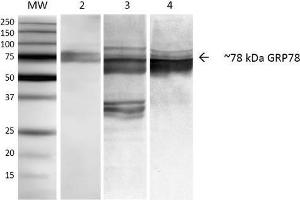 Western Blot analysis of Human, Mouse, Rat NIH3T3, Rat Brain, and HEK-293 cell lysates showing detection of ~78 kDa GRP78 protein using Mouse Anti-GRP78 Monoclonal Antibody, Clone 3C5-1A4 . (GRP78 Antikörper  (APC))