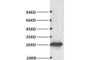 Western Blot analysis of Hela cells using BCL2 Monoclonal Antibody at dilution of 1:1000. (Bcl-2 Antikörper)
