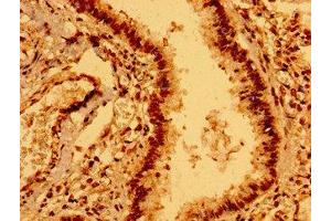 Immunohistochemistry of paraffin-embedded human lung tissue using ABIN7151731 at dilution of 1:100 (ECSCR Antikörper  (AA 25-124))