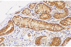 Immunohistochemistry of paraffin-embedded Human duodenum using CD38 Polycloanl Antibody at dilution of 1:200 (CD38 Antikörper)