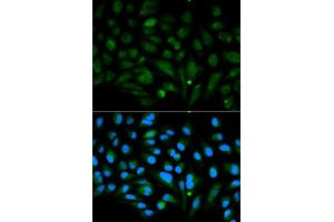 Immunofluorescence analysis of MCF7 cell using DCN antibody. (Decorin Antikörper  (AA 31-359))