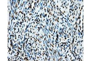 Immunohistochemistry (IHC) image for anti-Amyloid beta (A4) Precursor Protein (APP) antibody (ABIN1496877) (APP Antikörper)