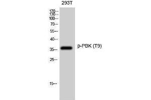 Western Blotting (WB) image for anti-PDZ Binding Kinase (PBK) (pThr9) antibody (ABIN3173023) (PBK Antikörper  (pThr9))