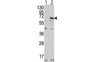 Western blot analysis of PRKR antibody and 293 cell lysate (2 ug/lane) either nontransfected (Lane 1) or transiently transfected with the EIF2AK2/PKR gene (2). (EIF2AK2 Antikörper  (AA 519-550))