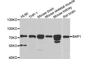 Western blot analysis of extracts of various cell lines, using BAP1 antibody (ABIN5973917) at 1/1000 dilution. (BAP1 Antikörper)