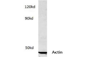 Image no. 2 for anti-Actin (pan) antibody (ABIN265298) (Actin Antikörper  (pan))