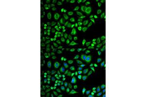 Immunofluorescence analysis of A549 cells using APOD antibody (ABIN5973043). (Apolipoprotein D Antikörper)