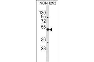 Western blot analysis in NCI-H292 cell line lysates (35ug/lane). (Annexin a10 Antikörper  (C-Term))