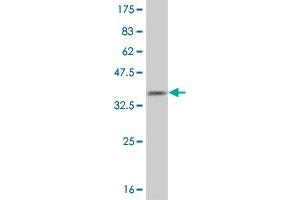 Western Blot detection against Immunogen (34. (OLIG1 Antikörper  (AA 80-159))