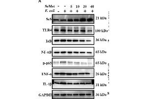 Western Blotting (WB) image for anti-Nuclear Factor-kB p65 (NFkBP65) (pSer536) antibody (ABIN730528)