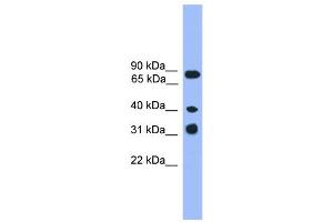 WB Suggested Anti-LAX1  Antibody Titration: 0. (LAX1 Antikörper  (C-Term))