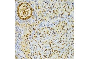 Immunohistochemistry of paraffin-embedded rat ovary using ALYREF antibody. (THO Complex 4 Antikörper)