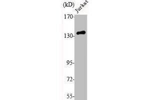 Western Blot analysis of Jurkat cells using N-cadherin Polyclonal Antibody (N-Cadherin Antikörper  (C-Term))