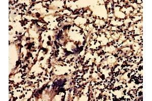 IHC image of ABIN7163135 diluted at 1:600 and staining in paraffin-embedded human appendix tissue performed on a Leica BondTM system. (Sphingomyelin Synthase 2 Antikörper  (AA 1-79))