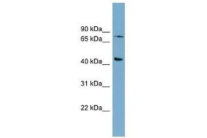 FZD6 antibody used at 1 ug/ml to detect target protein. (FZD6 Antikörper)