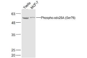 Lane 1: Mouse Testis lysates Lane 2: Human MCF-7 lysates probed with Phospho-cdc25A (Ser76) Polyclonal Antibody, Unconjugated  at 1:500 dilution and 4˚C overnight incubation. (CDC25A Antikörper  (pSer76))