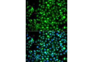 Immunofluorescence analysis of A549 cells using NME2 antibody. (NME2 Antikörper  (AA 1-152))