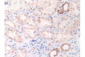 IHC-P analysis of Human Kidney Tissue, with DAB staining. (HSPD1 Antikörper  (AA 172-343))