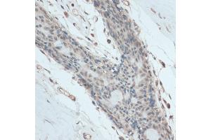 Immunohistochemistry of paraffin-embedded human breast using antibody (ABIN6130837, ABIN6140958, ABIN6140959 and ABIN6214740) at dilution of 1:100 (40x lens). (GAPDHS Antikörper  (AA 179-408))
