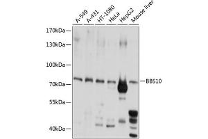 Western blot analysis of extracts of various cell lines, using BBS10 antibody  at 1:1000 dilution. (BBS10 Antikörper  (AA 474-723))