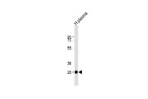 Anti-CFD Antibody (N-term) at 1:2000 dilution + human plasma lysate Lysates/proteins at 20 μg per lane. (Adipsin Antikörper  (N-Term))