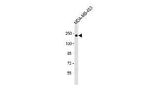 Anti ERBB2 Antibody  at 1:500 dilution + MDA-MB-453 whole cell lysate Lysates/proteins at 20 μg per lane. (ErbB2/Her2 Antikörper  (AA 706-735))