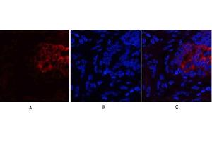 Immunofluorescence analysis of human lung tissue. (PI3K p85 alpha/gamma Antikörper)