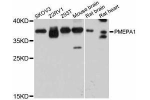 Western blot analysis of extracts of various cell lines, using PMEPA1 antibody. (PMEPA1 Antikörper)
