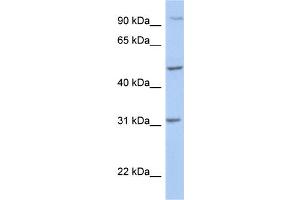 WB Suggested Anti-PPM1J Antibody Titration: 0. (PPM1J Antikörper  (C-Term))