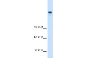 Western Blotting (WB) image for anti-Microsomal Triglyceride Transfer Protein (MTTP) antibody (ABIN2462724) (MTTP Antikörper)