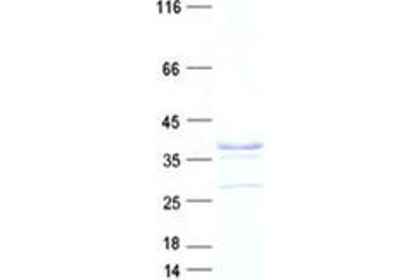 Chromosome 7 Open Reading Frame 20 (C7orf20) protein (DYKDDDDK Tag)