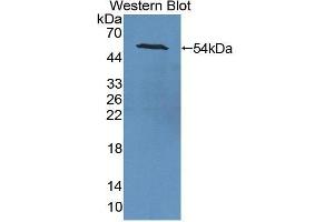 Western Blotting (WB) image for anti-Transmembrane Protein 27 (TMEM27) antibody (ABIN1866219) (TMEM27 Antikörper)