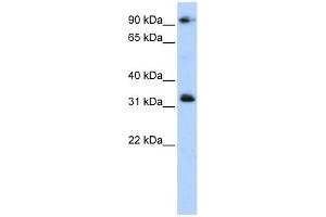 CCDC69 antibody used at 1 ug/ml to detect target protein. (CCDC69 Antikörper  (Middle Region))