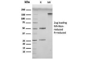 SDS-PAGE Analysis Purified N-Cadherin Mouse Monoclonal Antibody (13A9). (N-Cadherin Antikörper  (Cytoplasmic Domain))