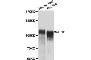 Western blot analysis of extracts of various cell lines, using HGF antibody (ABIN5970537) at 1:400 dilution. (HGF Antikörper)