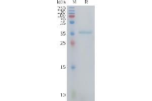 CCL3 Protein (AA 27-92) (Fc Tag)