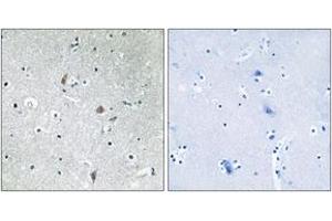 Immunohistochemistry (IHC) image for anti-Mechanistic Target of Rapamycin (serine/threonine Kinase) (mTOR) (pSer2448) antibody (ABIN2888475) (MTOR Antikörper  (pSer2448))
