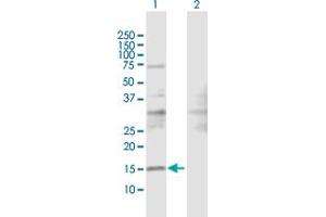 Lane 1: SRP19 transfected lysate ( 16. (SRP19 293T Cell Transient Overexpression Lysate(Denatured))