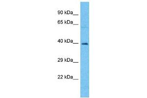 Western Blotting (WB) image for anti-Olfactory Receptor, Family 4, Subfamily A, Member 15 (OR4A15) (N-Term) antibody (ABIN2774563) (OR4A15 Antikörper  (N-Term))