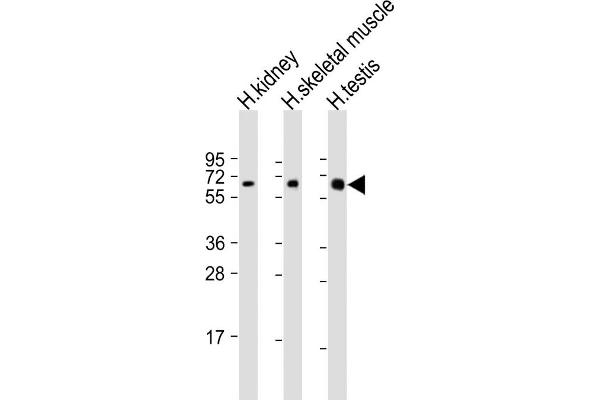 DMRT2 Antikörper  (AA 357-392)