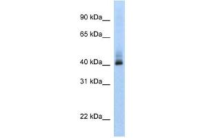 ANKRD42 antibody used at 1 ug/ml to detect target protein. (ANKRD42 Antikörper  (N-Term))