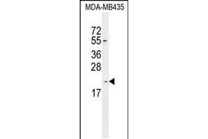 Western blot analysis in MDA-MB435 cell line lysates (35ug/lane). (KLLN Antikörper  (C-Term))