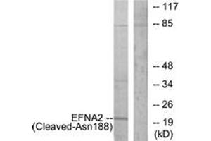 Western Blotting (WB) image for anti-Ephrin A2 (EFNA2) (AA 139-188), (Cleaved-Asn188) antibody (ABIN2891194) (Ephrin A2 Antikörper  (Cleaved-Asn188))