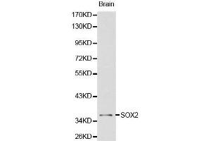 Western Blotting (WB) image for anti-SRY (Sex Determining Region Y)-Box 2 (SOX2) (AA 1-140) antibody (ABIN6213889) (SOX2 Antikörper  (AA 1-140))