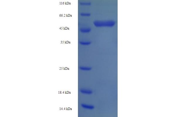 OXCT1 Protein (AA 40-520) (His tag)