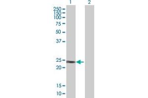 Western Blot analysis of HRAS expression in transfected 293T cell line by HRAS MaxPab polyclonal antibody. (HRAS Antikörper  (AA 1-189))